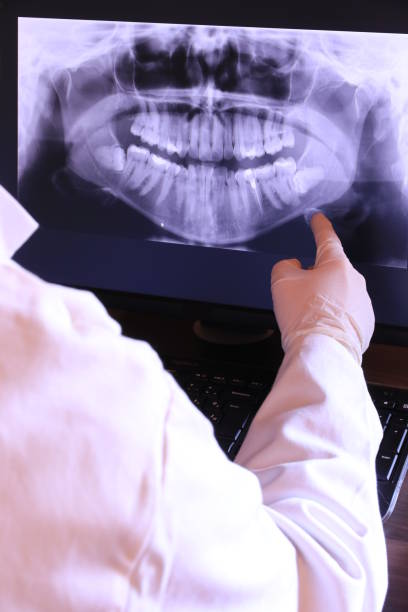 Best Emergency Treatment for Dental Infections or Abscesses in Dexter, NM